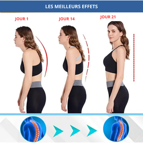 Correcteur de Posture Intelligent J-3000.